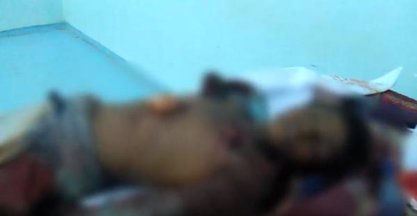 إستشهاد طفل بإنفجار لغم حوثي في الخوخة بالحديدة (فيديو)