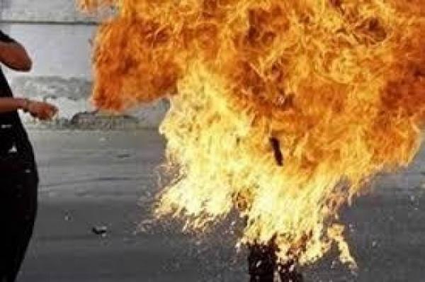 مواطن يمني يحرق نفسه احتجاجا على نهب عصابة حوثية لأرضيته