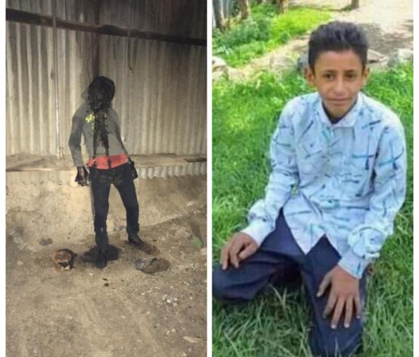 العثور على جثة طفل متفحمة في أحد المباني المهجورة في الشعر بإب
